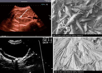 7 Expert Secrets for Accurate Real Oviedo vs Almeria Prediction You Need to Know!