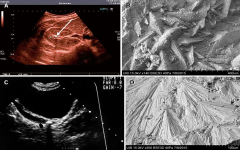 7 Expert Secrets for Accurate Real Oviedo vs Almeria Prediction You Need to Know!